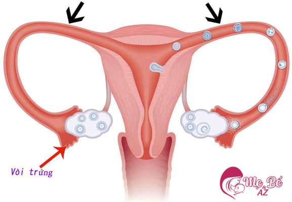 Hỏi - Đáp: Các bệnh phụ khoa sau khi sinh và cách phòng tránh