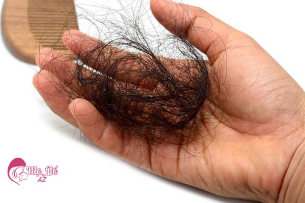 sau sinh bao lâu thì rụng tóc