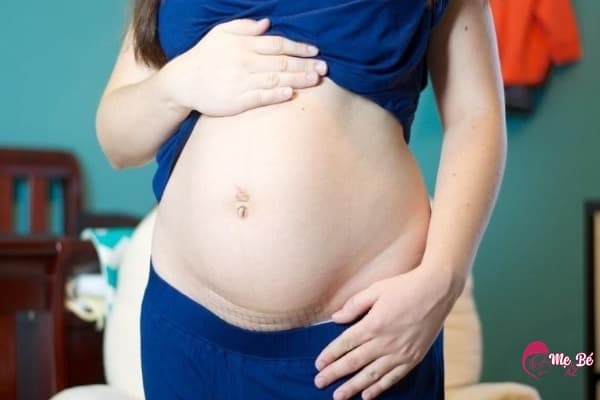 Rất nhiều nguy cơ khi vừa sinh mổ đã mang thai