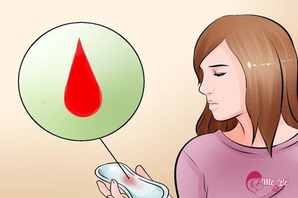 Chảy máu âm đạo là dấu hiệu điển hình của mang thai ngoài tử cung
