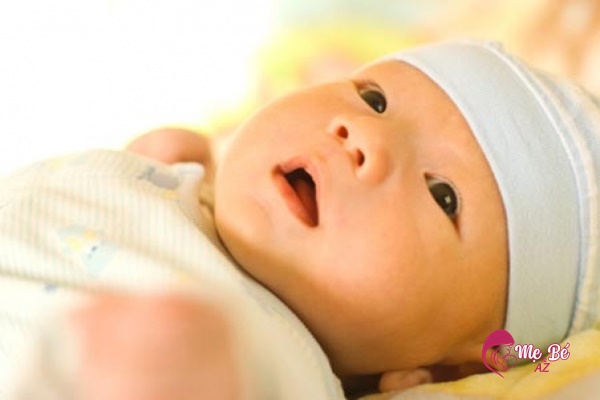 Vàng da ở trẻ sơ sinh là hiện tượng khá phổ biến