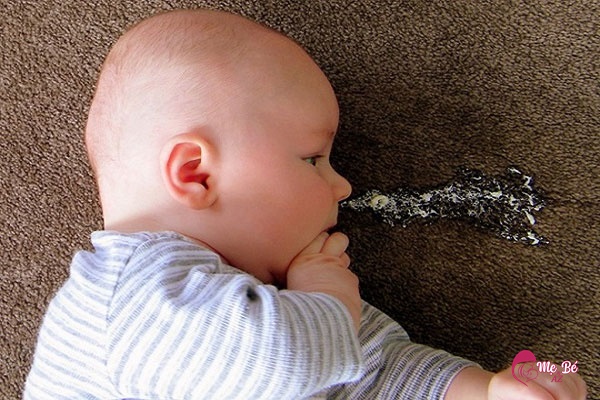 Đừng chủ quan khi trẻ sơ sinh sặc sữa - Những cách khắc phục mẹ nên bỏ túi