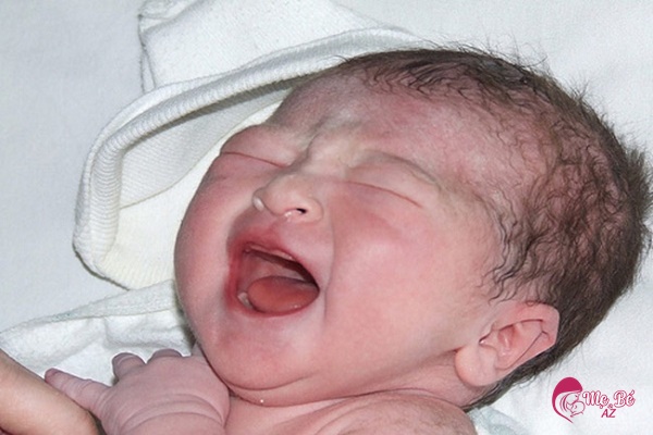Góc lý giải: Trẻ sơ sinh bị sài đẹn và cách chữa như thế nào?