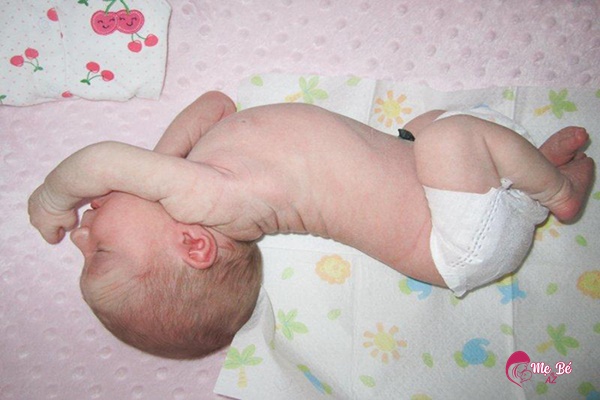 Những vấn đề sinh lý ở trẻ sơ sinh thường gặp