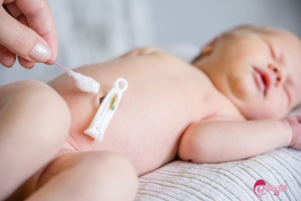 Mẹ vệ sinh rốn cho trẻ kém